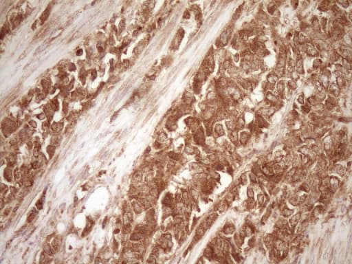 BCL2 / Bcl-2 Antibody (clone OTI9D3)