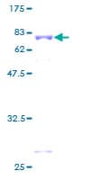 Human ZMYND10 Protein (Recombinant GST)