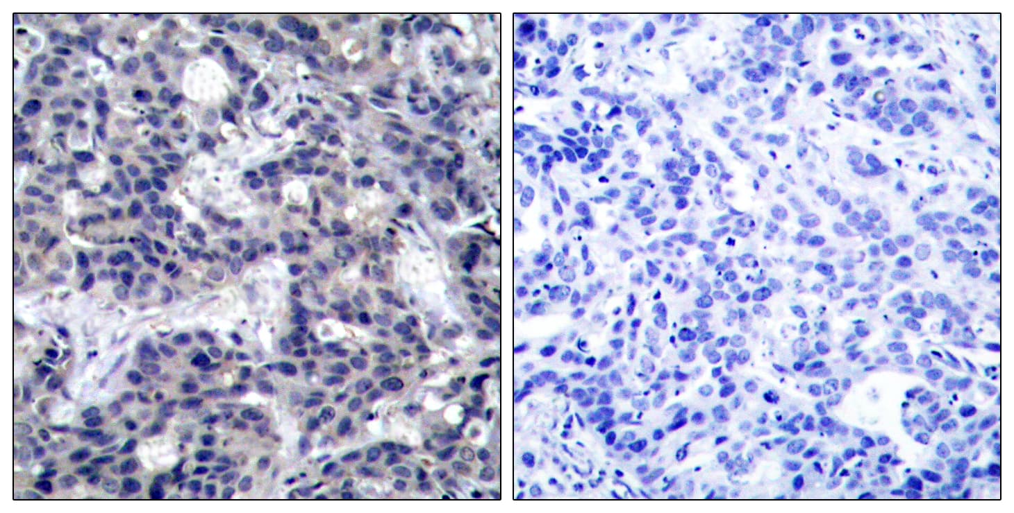 Polyclonal Rabbit anti-Human EIF2AK2 / PKR Antibody (aa413-462, IHC, WB)