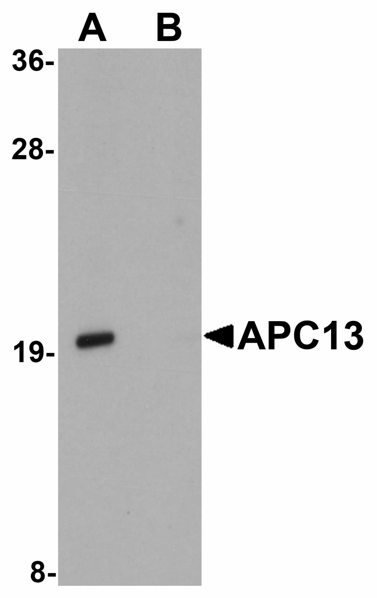 IHC-plus™ Polyclonal Rabbit anti-Human ANAPC13 Antibody (IHC, IF, WB)
