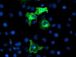 ANAPC2 / APC2 Antibody (clone OTI1B12)