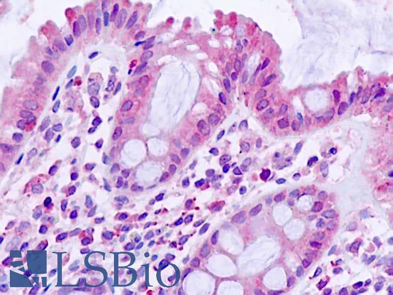 PathPlus™ TGFBR1 / ALK5 Antibody (aa50-63)