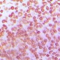 Polyclonal Rabbit anti-Human TFDP1 Antibody (C-Terminus, IHC, IF, WB)