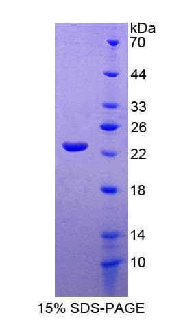 Rat IL-10 Protein (Recombinant His-T7)