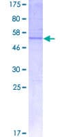 Human Claudin 20 / CLDN20 Protein (Recombinant GST)