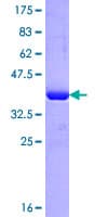 Human IMPG2 Protein (Recombinant GST, N-terminus)