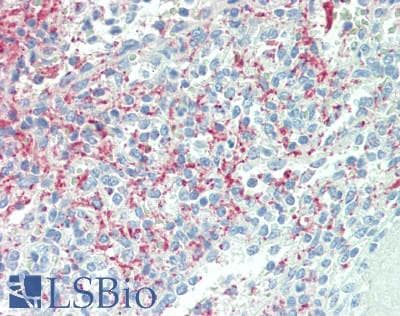IHC-plus™ Polyclonal Rabbit anti-Human SRGN / Serglycin Antibody (IHC, IF, WB)