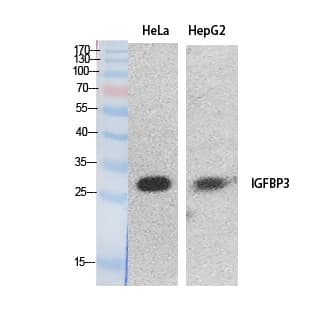 IGFBP3 Antibody