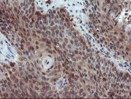 PYCARD / ASC / TMS1 Antibody (clone OTI3E9, Carrier-free)