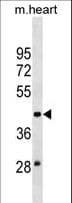 Polyclonal Rabbit anti-Human MOCS3 Antibody (aa40-66, WB)