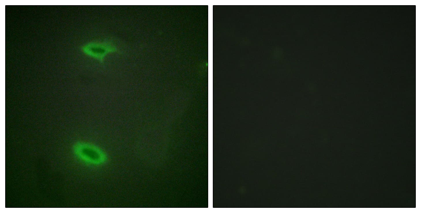 DLGAP1 Antibody (aa791-840)