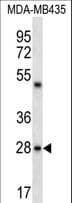 CDRT15L2 Antibody (aa215-243)