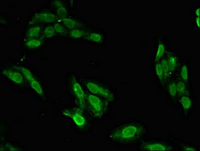 BRIP1 / BACH1 Antibody