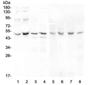 KCNN4 / KCa3.1 Antibody