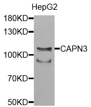 CAPN3 / Calpain 3 Antibody (AP)