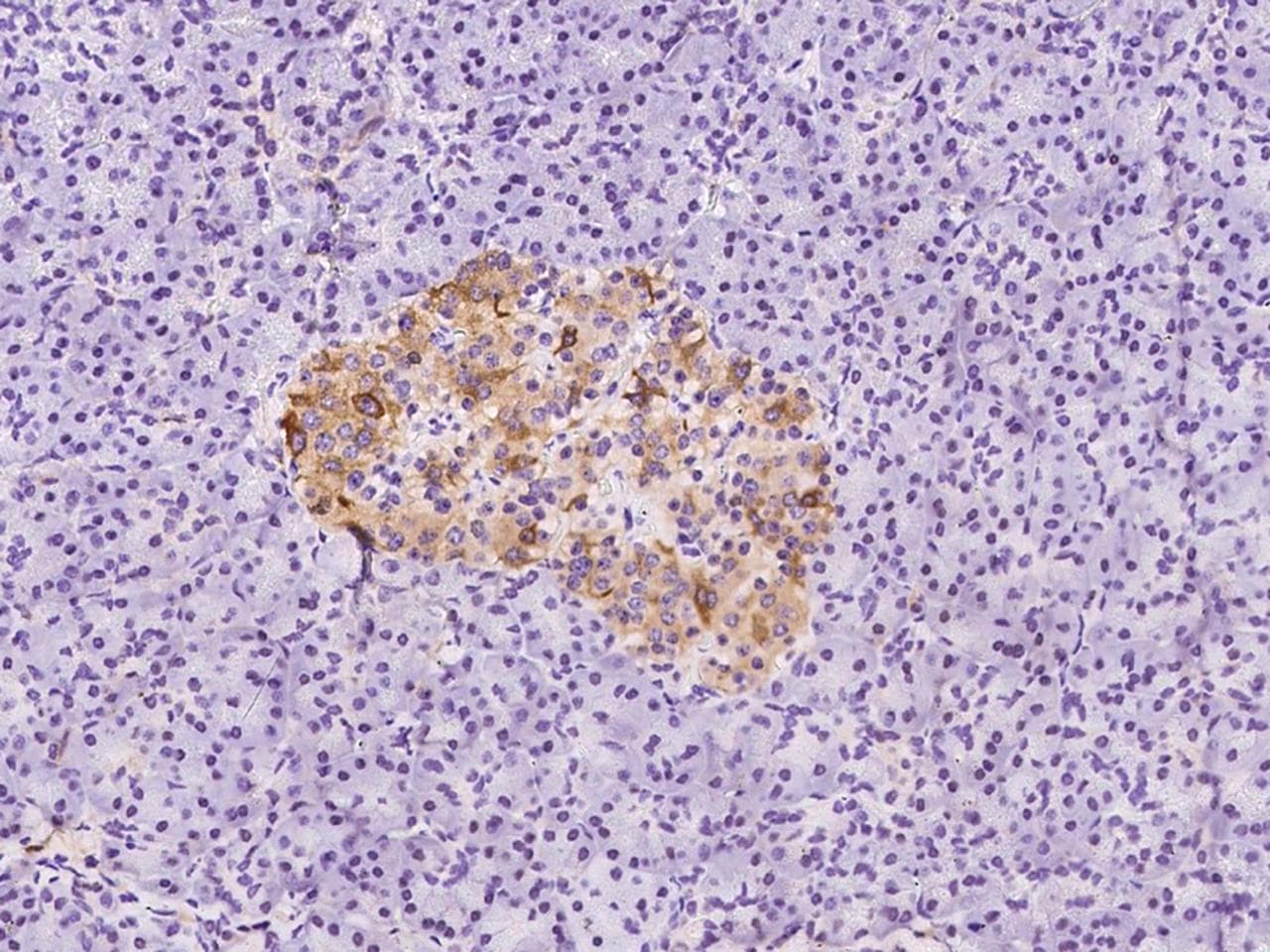 FTL / Ferritin Light Chain Antibody (Preservative Free)