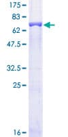Human BHMT Protein (Recombinant GST)