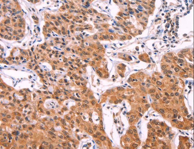 IL1RL1 Antibody