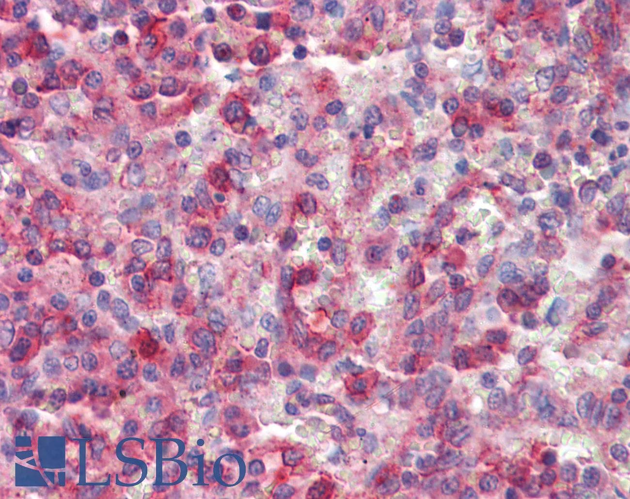 IHC-plus™ Polyclonal Goat anti-Human P40PHOX / NCF4 Antibody (aa228-238, IHC, WB)