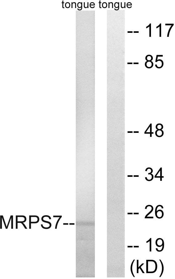 Polyclonal Rabbit anti-Human MRPS7 Antibody (IHC, WB)