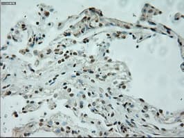 Monoclonal Mouse anti-Human L1CAM Antibody (clone OTI10C12, IHC, WB)
