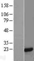 Human MFAP5 / MAGP2 Protein (Over-Expression Lysate Myc-DDK (Flag))