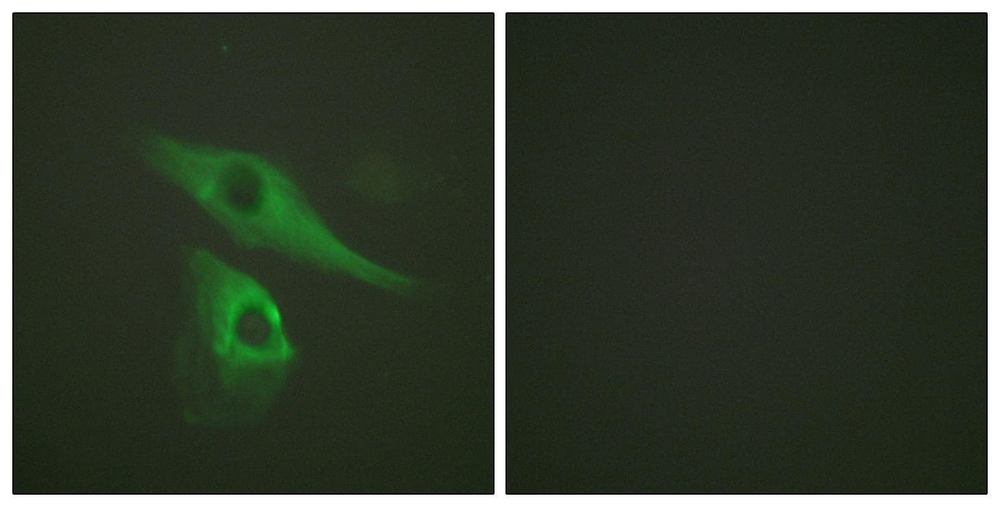 Polyclonal Rabbit anti-Human KRT8 / CK8 / Cytokeratin 8 Antibody (p73, IHC, IF, WB)