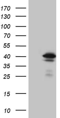 Monoclonal Mouse anti-Human STX18 / Syntaxin 18 Antibody (clone OTI3D7, Carrier-free, aa1-285, IHC, WB)
