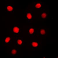 Polyclonal Rabbit anti-Human ESPL1 / Separase Antibody (phospho-Ser801, IHC, IF, WB)