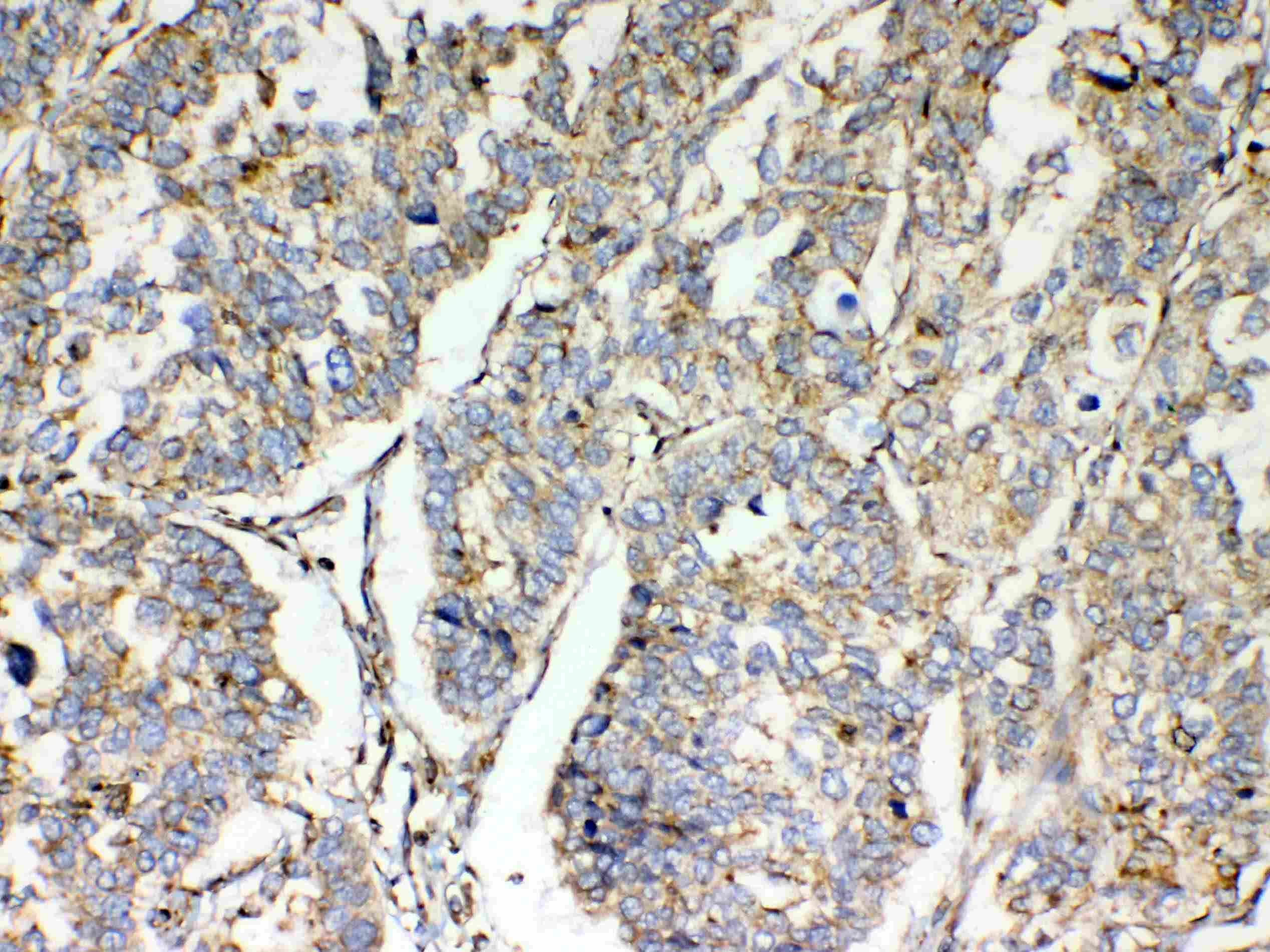 Polyclonal Rabbit anti-Human TSPAN12 Antibody (IHC, WB)