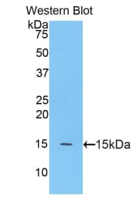 Beta-N-Acetylglucosaminidase Antibody (aa695-814)