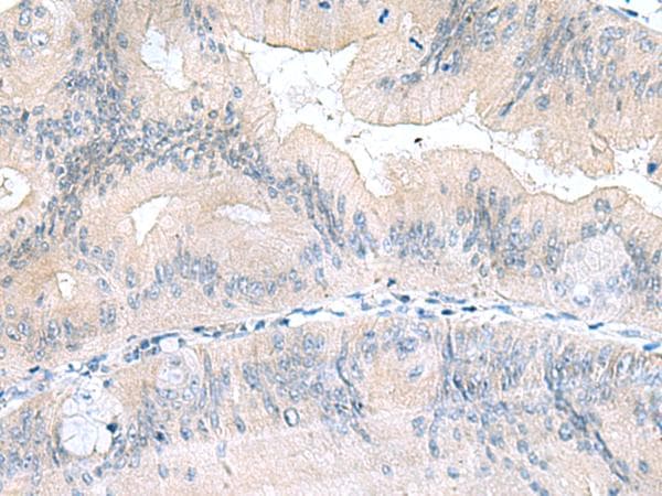 Polyclonal Rabbit anti-Human UBE2F Antibody (IHC)