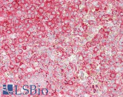 Polyclonal Rabbit anti-Human NFKB2 Antibody (aa38-343, IHC, WB)