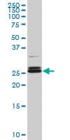 Monoclonal Mouse anti-Human PAFAH1B3 Antibody (clone 3G6, WB)