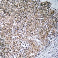 CHST13 Antibody (Internal)
