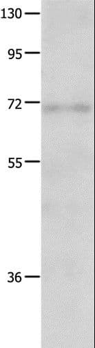 CRD-BP / ZBP1 / IGF2BP1 Antibody