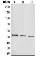 PARK2 / Parkin 2 Antibody (N-Terminus)