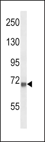 VCAM1 / CD106 Antibody (aa295-322)
