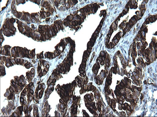 CD74 / CLIP Antibody (clone OTI1H3)