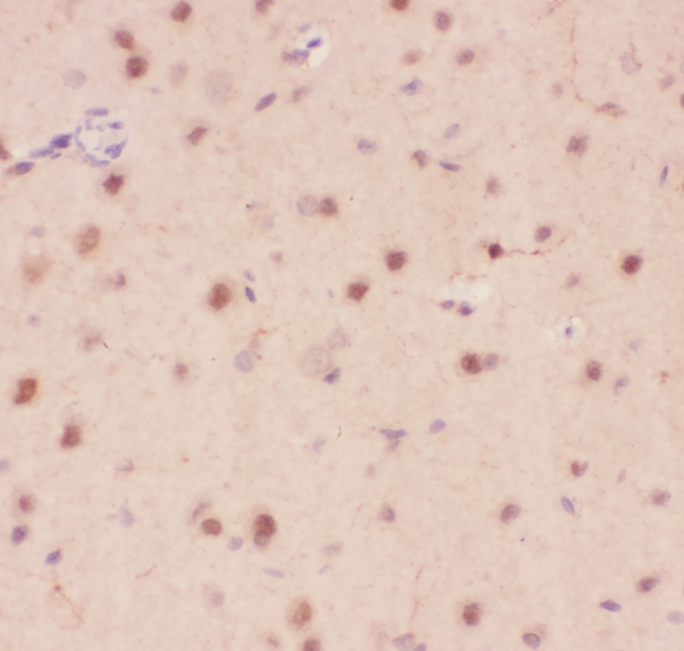 CRK Antibody (aa2-246)