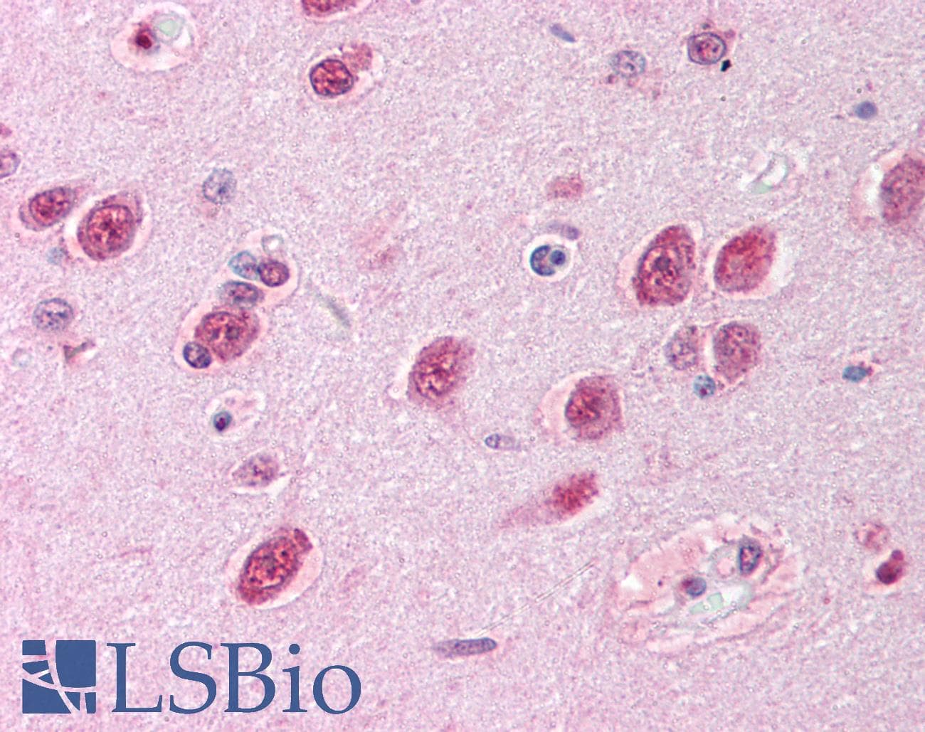 IHC-plus™ AKT1 Antibody (phospho-Thr308)