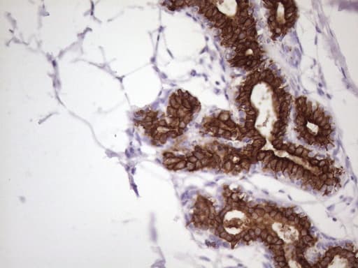KRT16 / CK16 / Cytokeratin 16 Antibody (clone 7A4, Carrier-free)