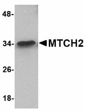 IHC-plus™ Polyclonal Rabbit anti-Human MTCH2 Antibody (IHC, IF, WB)