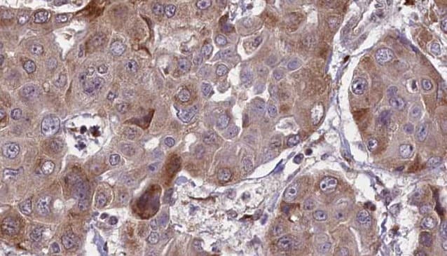 EPCAM Antibody