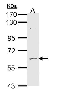 ADCK1 Antibody (aa45-213)