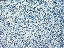 Monoclonal Mouse anti-Human CYPOR / POR Antibody (clone OTI1B11, IHC, IF, WB)