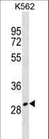 ZNF365 Antibody (aa50-77)