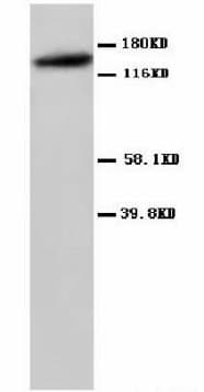 GRIN2A / NMDAR2A / NR2A Antibody (aa1411-1427, Magnetic beads)