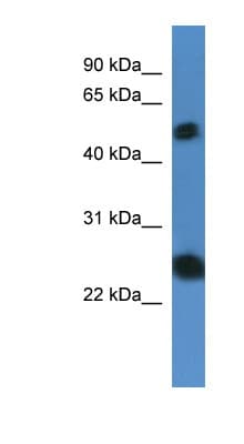 SLA2 / SLAP2 Antibody (aa66-115)