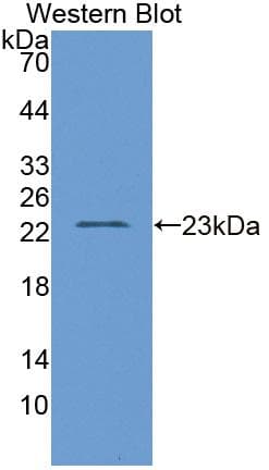 D2HGDH Antibody (aa56-232, PE)